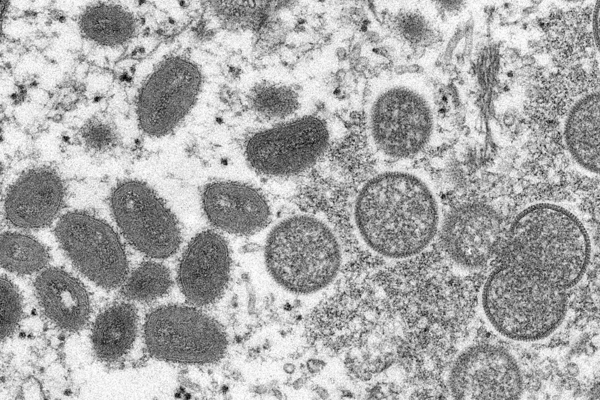 Airborne Transmission Of Monkeypox ‘has Not Been Reported,’ Cdc Says