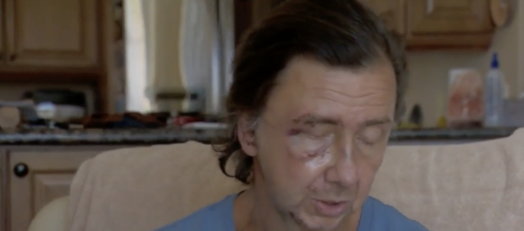 Deputies: Central Florida Suspect Beat Man With Golf Club In Argument Over Walking On Pathway