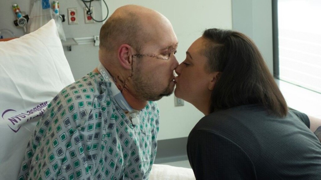 World’s First Whole Eye And Partial Face Transplant Gives Arkansas Man New Hope