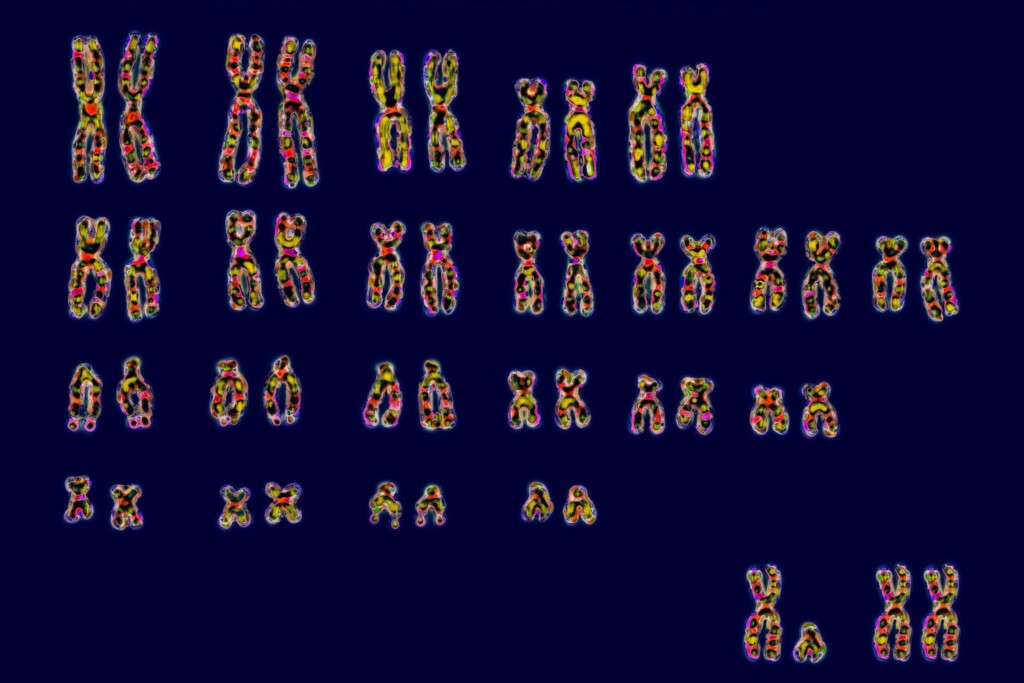Why Are Women At Greater Risk Of Autoimmune Diseases Like Ms? New Study Finds Clue