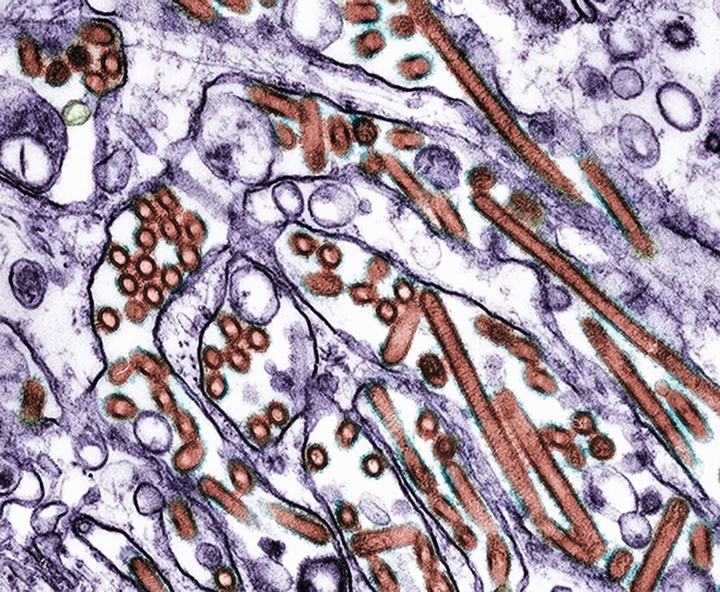 Bird Flu Virus Isolated From Hospitalized Canadian Teen Shows Signs Of Human Adaptation