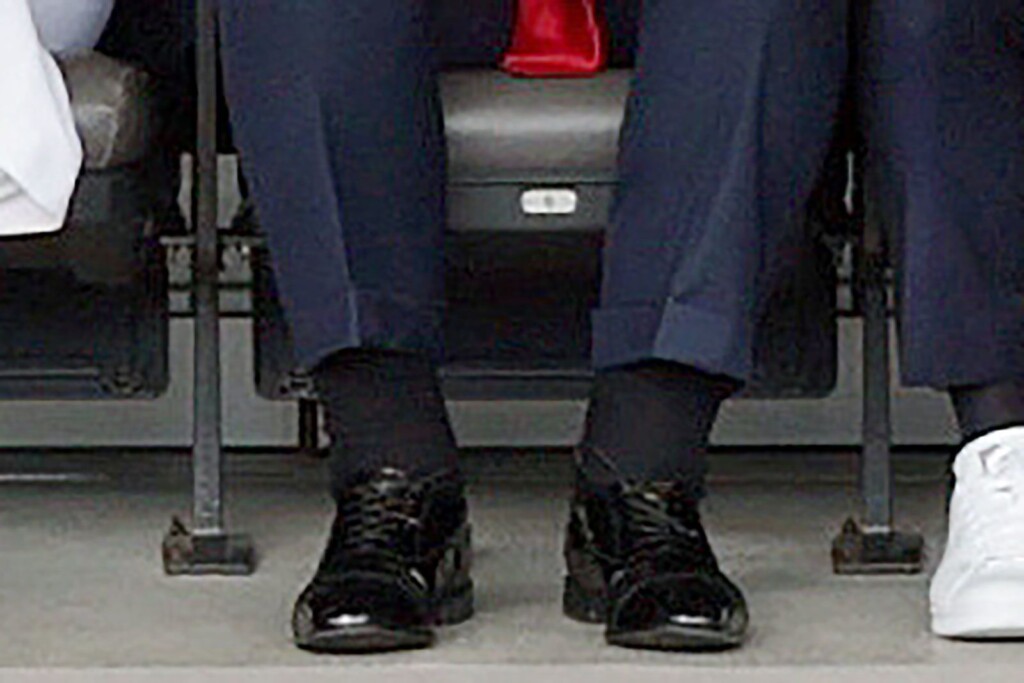 Trump Diagnosed With Chronic Venous Insufficiency Following Leg Swelling