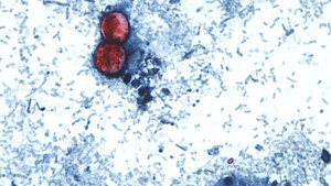 Tracking The Largest Cyclosporiasis Outbreak In The Us