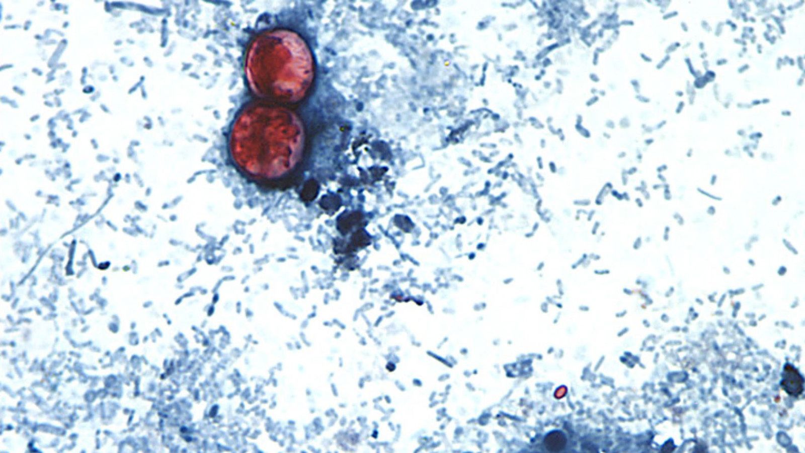 Tracking The Largest Cyclosporiasis Outbreak In The Us