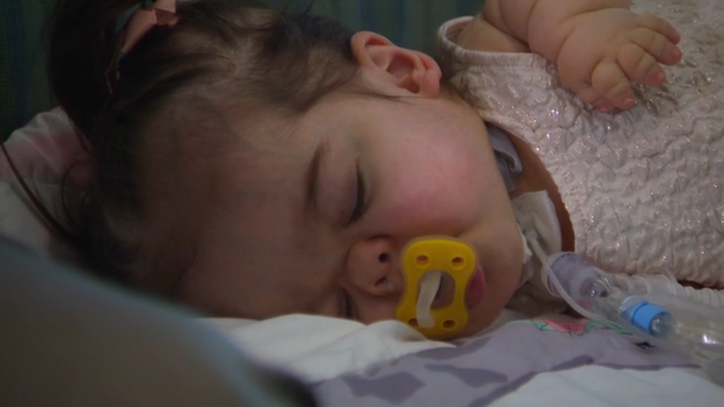 Toddler With Rare Genetic Disorder Wins National Title
