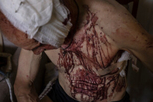 Russian Attacks Against Civilians In Ukraine Amount To War Crimes, Un Backed Investigation Finds