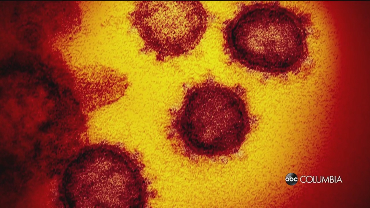 Dhec: 586 New Confirmed Cases Of Covid 19, 2 New Deaths In Sc