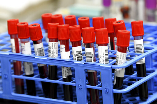 Years Of Research Laid Groundwork For Speedy Covid 19 Shots