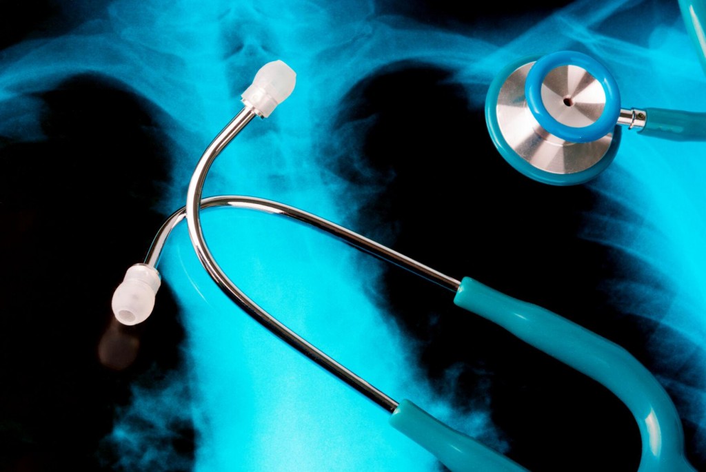 How Lung Restoration Improves Organ Availability