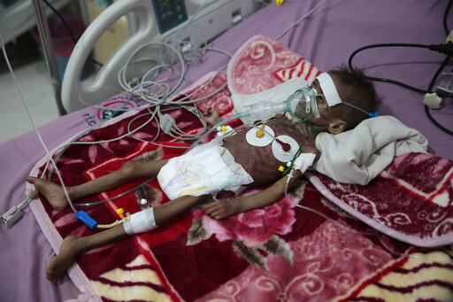 Un Warns Covid 19 Is `roaring Back’ As Yemen Faces Famine