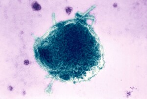 Pennsylvania Reports Fourth Measles Related Death, The Most In Us In Decades